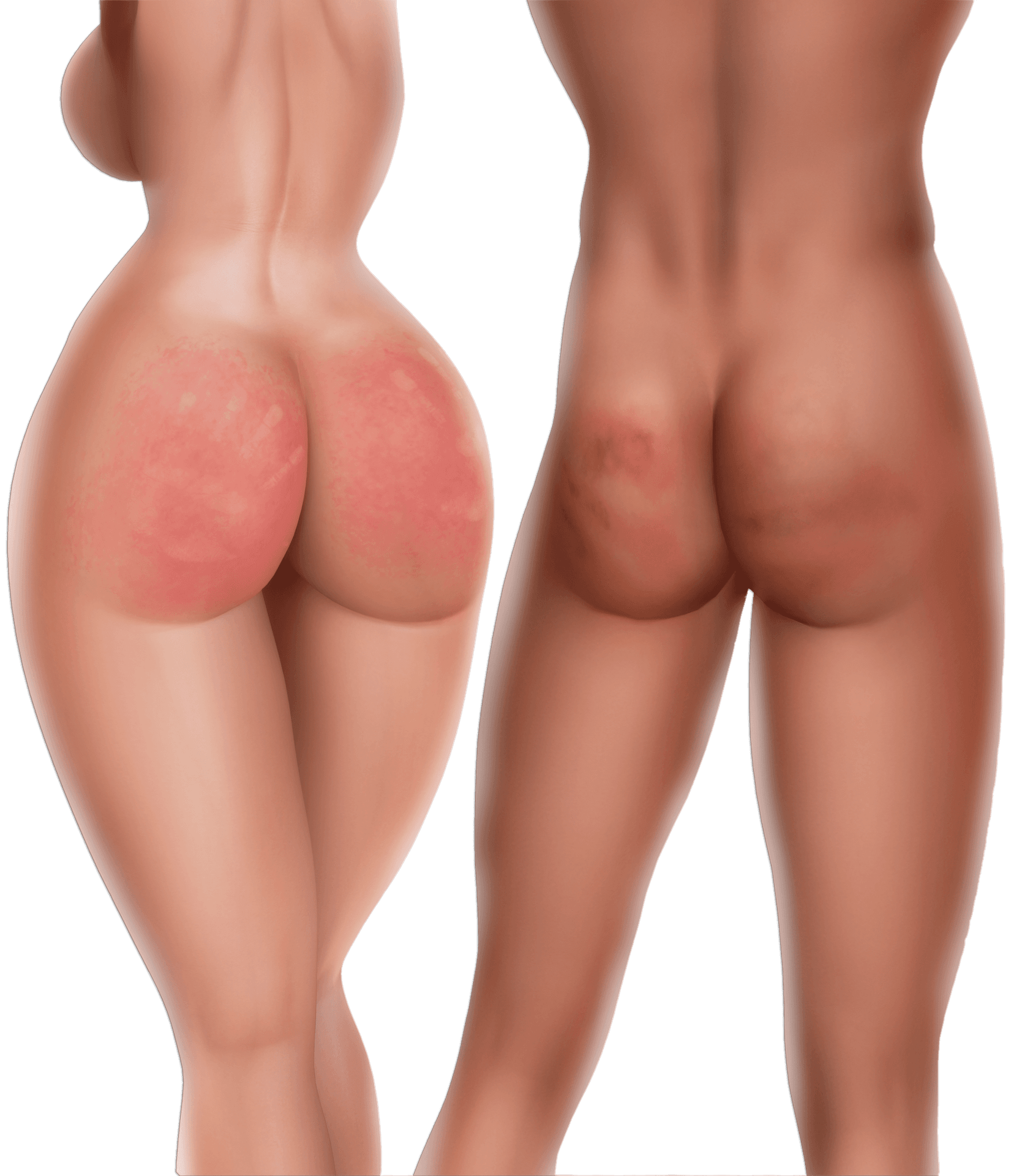 Lovense Device Connection Guide